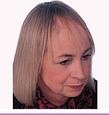 Thin Hair Peices For Thinning Top And Sides | coping with partial hair loss Thin Hair Peices For Thinning Top And Sides | coping with partial hair loss